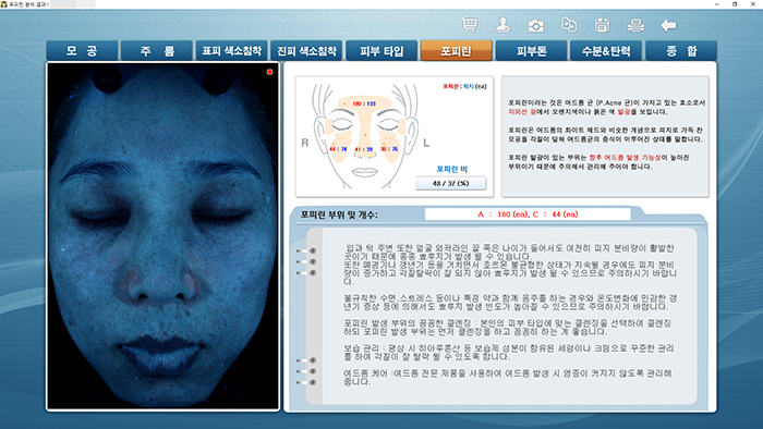 포피린