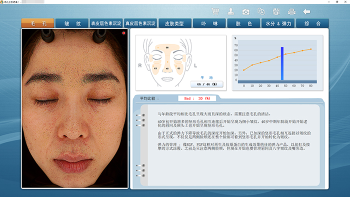 毛孔