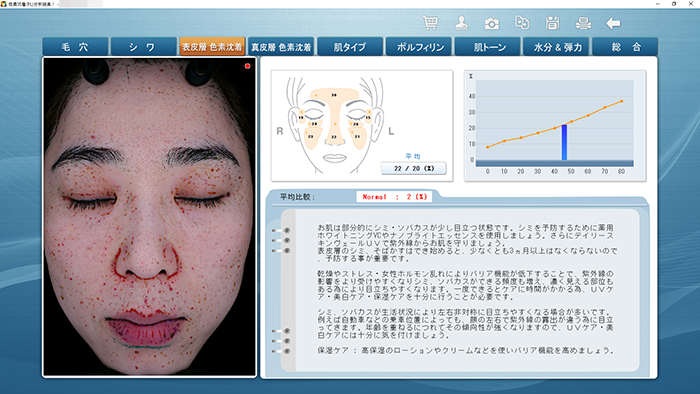 表皮　色素沈着