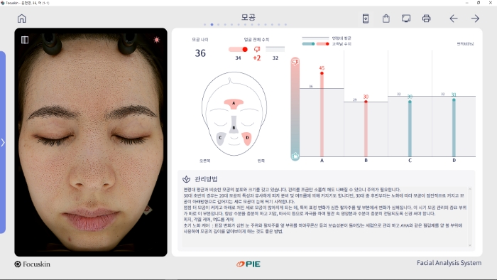 모공