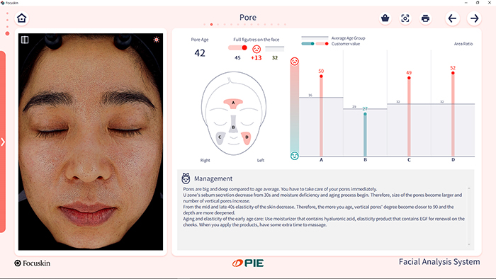 Pore