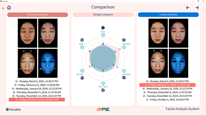 Comparison analysis