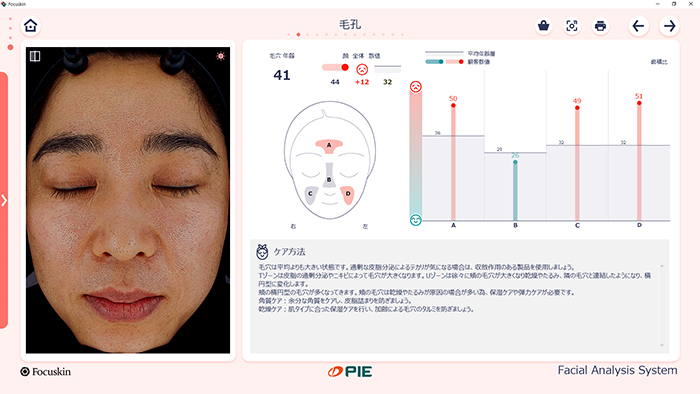 毛穴