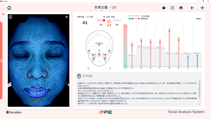 UV色素沈着