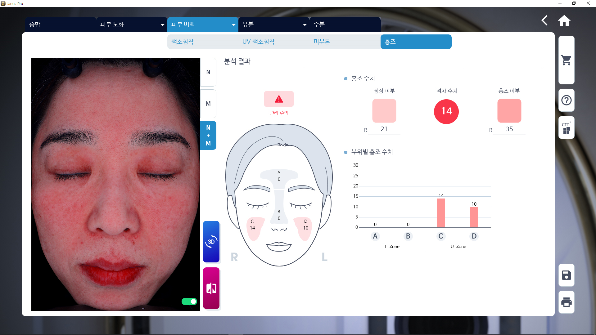 홍조