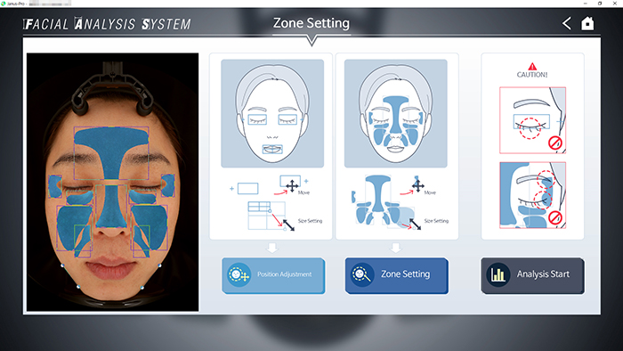 Zone Setting