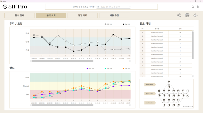 분석 이력